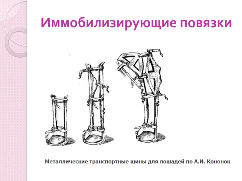 Иммобилизирующие повязки